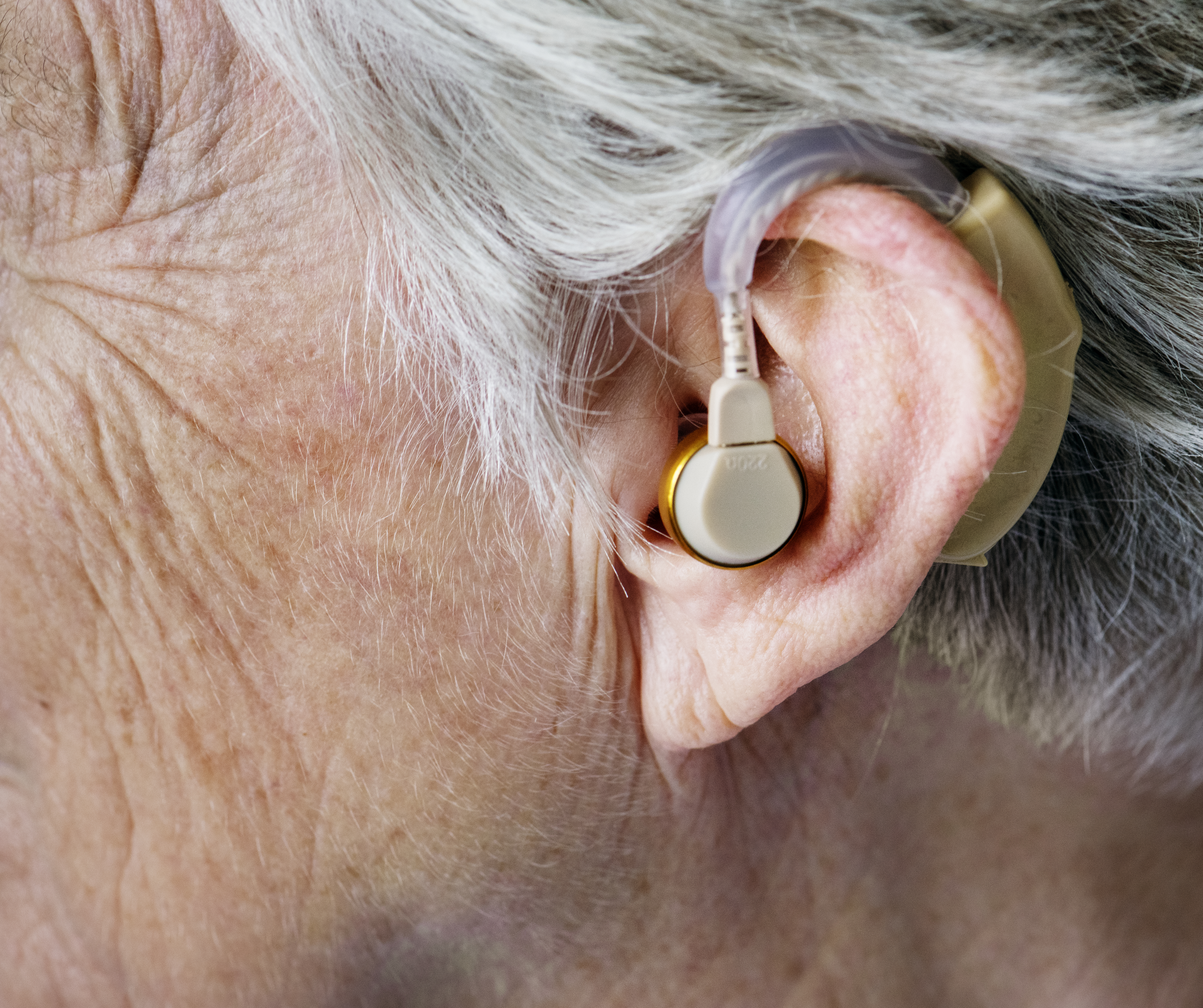 Peut-on acheter un appareil auditif en pharmacie ?